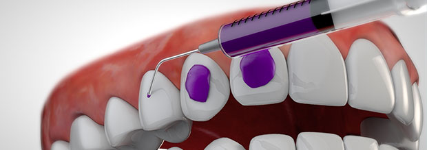 3d-odontotecnico