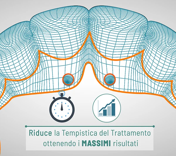 video-3d-tecnica-impianto-dentale